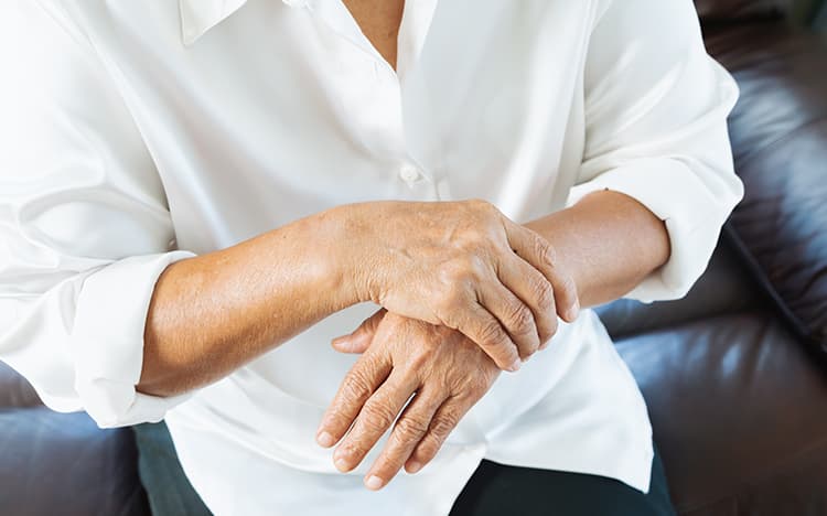 Artritis reumatoide