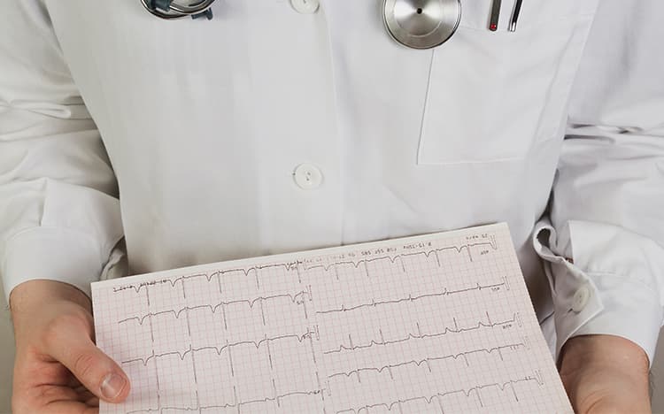 Electrocardiograma (ECG)